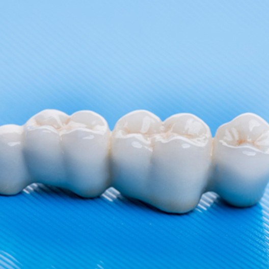 A dental bridge against a blue background