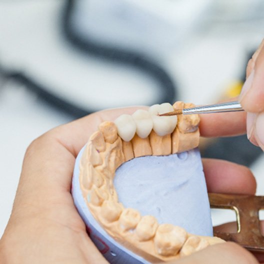 A closeup of a dental bridge being made by a lab technician