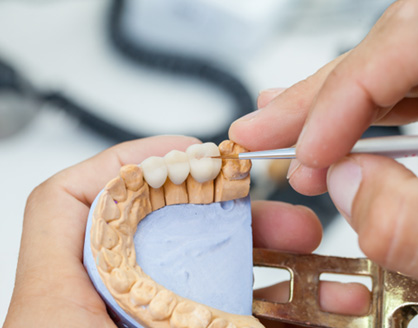 Lab artisan working on dental bridge