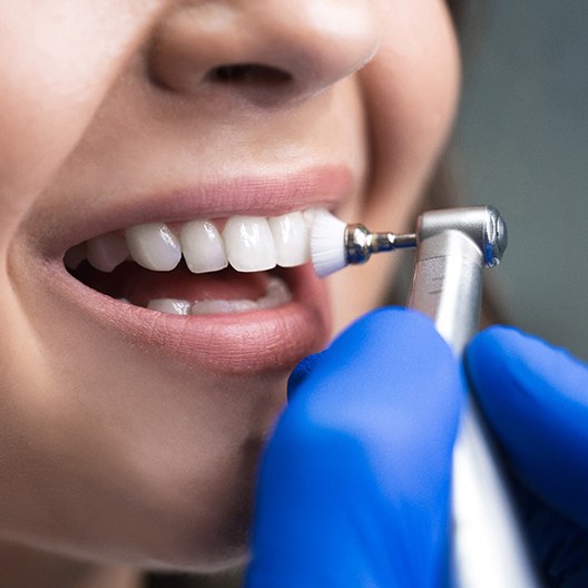 a patient undergoing a teeth cleaning