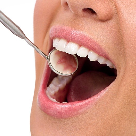 Dentist checking patient's metal free dental restoration