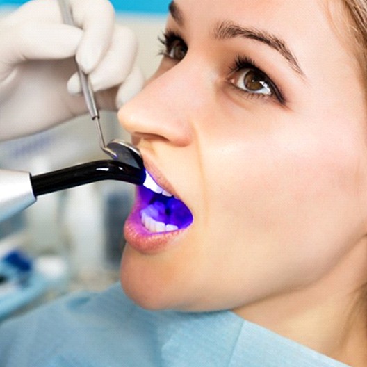 woman getting dental bonding in Arlington, TX