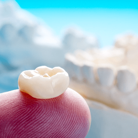 Closeup of dental crowns in Arlington