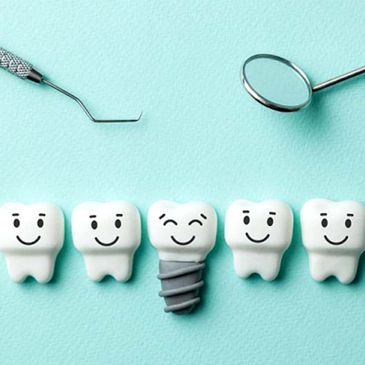 Illustration of dental implant in Arlington