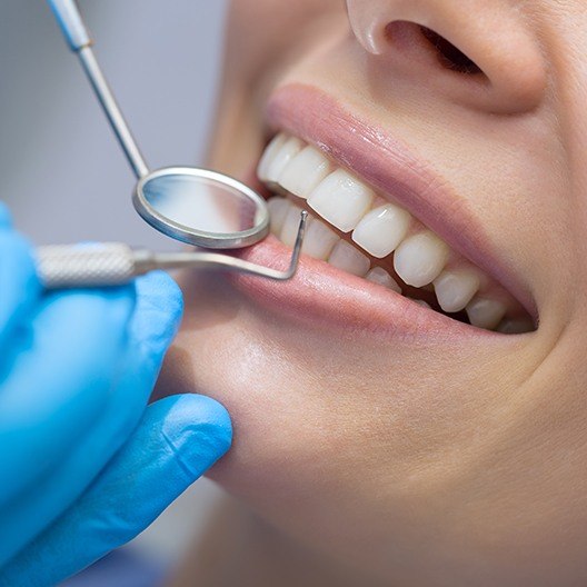 Patient receiving scaling and root planing periodontal therapy