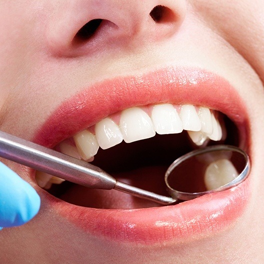 Dentist checking patient's smile after tooth colored filling