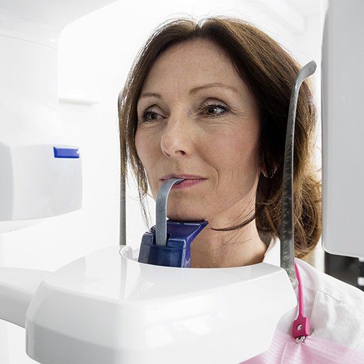 Woman receiving panoramic x-ray scan
