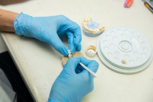 Dental lab making restorations and dental crowns