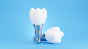 Two dental implants against a blue background