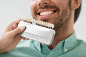 Man choosing his veneers shade